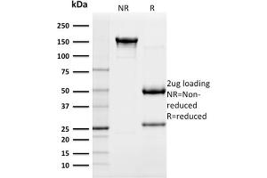 SDS-PAGE Analysis Purified CD117 Mouse Monoclonal Antibody (KIT/982). (KIT anticorps  (AA 100-300))
