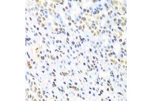 Immunohistochemistry of paraffin-embedded rat kidney using RUNX1 Antibody (ABIN3022803, ABIN3022804, ABIN3022805 and ABIN6219236) at dilution of 1:100 (40x lens).