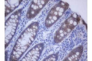 Image no. 2 for anti-Cadherin 1, Type 1, E-Cadherin (Epithelial) (CDH1) antibody (ABIN1497942)