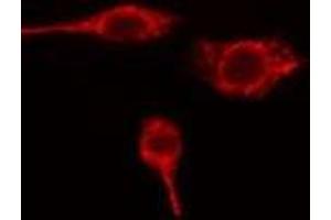 ABIN6275674 staining HuvEc cells by IF/ICC. (VTI1B anticorps  (Internal Region))
