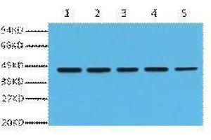 Western Blotting (WB) image for anti-Actin, beta (ACTB) antibody (ABIN3181101) (beta Actin anticorps)