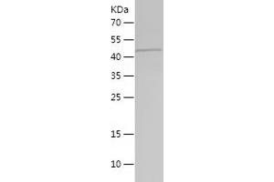 Western Blotting (WB) image for Actin Related Protein 2/3 Complex, Subunit 1B, 41kDa (ARPC1B) (AA 175-372) protein (His-IF2DI Tag) (ABIN7121651)