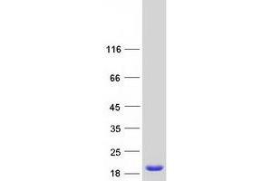 Validation with Western Blot