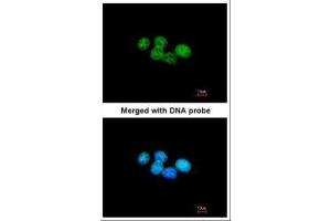 ICC/IF Image Immunofluorescence analysis of paraformaldehyde-fixed A431, using ERCC8(CSA), antibody at 1:200 dilution.