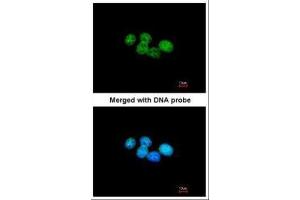 ICC/IF Image Immunofluorescence analysis of paraformaldehyde-fixed A431, using ERCC8(CSA), antibody at 1:200 dilution. (ERCC8 anticorps  (Internal Region))