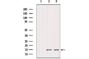 Western blot analysis of extracts from various samples, using SERF2 Antibody. (SERF2 anticorps  (N-Term))