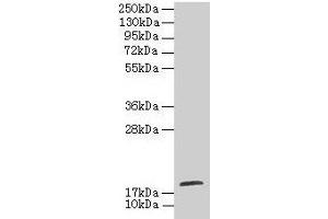 Western blot All lanes: TPPP2 antibody at 8 μg/mL + HepG2 whole cell lysate Secondary Goat polyclonal to rabbit IgG at 1/10000 dilution Predicted band size: 19 kDa Observed band size: 19 kDa (TPPP2 anticorps  (AA 1-170))