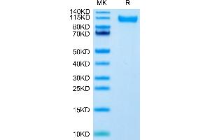 SDS-PAGE (SDS) image for SARS-CoV-2 Spike S1 (B.1.617.2 - delta) protein (His tag) (ABIN7274459)
