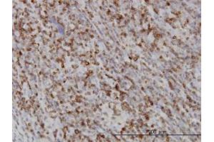 Image no. 2 for anti-RAB27A, Member RAS Oncogene Family (RAB27A) (AA 122-222) antibody (ABIN598569) (RAB27A anticorps  (AA 122-222))