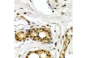 Immunohistochemistry of paraffin-embedded human mammary gland using ATF2 antibody.