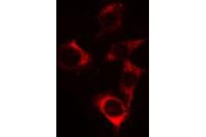 ABIN6269192 staining Hela cells by IF/ICC.
