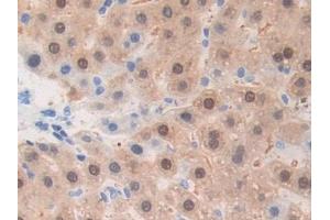 DAB staining on IHC-P; Samples: Rat Liver Tissue (ADAM1 anticorps  (AA 463-727))
