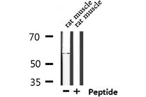 Western blot analysis of extracts from rat muscle, using TIGD4 Antibody. (TIGD4 anticorps  (Internal Region))