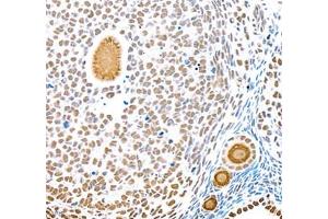 Immunohistochemistry of paraffin embedded rat ovary using Top2 (ABIN7075937) at dilution of 1:600 (400x lens)