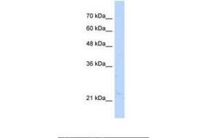 Image no. 1 for anti-Nudix (Nucleoside Diphosphate Linked Moiety X)-Type Motif 16-Like 1 (NUDT16L1) (AA 141-190) antibody (ABIN321453)