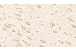 Detection of ADPN in Porcine Cerebrum Tissue using Polyclonal Antibody to Adiponectin (ADPN) (ADIPOQ anticorps  (AA 17-243))