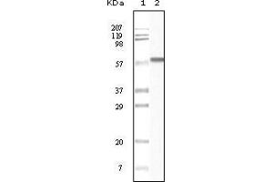 Western blot analysis using CK1 mouse mAb against truncated CK1 recombinant protein. (CSNK1A1 anticorps)