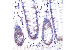 Immunohistochemistry of paraffin-embedded human colon using LXRα Rabbit mAb (ABIN1679005, ABIN3018365, ABIN3018366 and ABIN7101602) at dilution of 1:100 (40x lens). (NR1H3 anticorps)