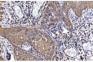 IHC analysis of HGS using anti-HGS antibody (ABIN7601206).