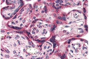 Placenta, Human: Formalin-Fixed, Paraffin-Embedded (FFPE)