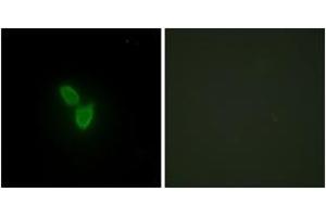 Immunofluorescence analysis of HepG2 cells, using PARD3 Antibody. (PARD3 anticorps  (AA 1141-1190))