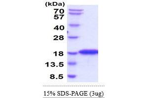 SDS-PAGE (SDS) image for DNA segment, Chr 17, Wayne State University 104, expressed (D17Wsu104e) (AA 25-166) protein (His tag) (ABIN6388124)