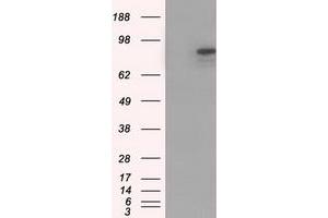 Western Blotting (WB) image for anti-Cadherin 13 (CDH13) antibody (ABIN1497419) (Cadherin 13 anticorps)