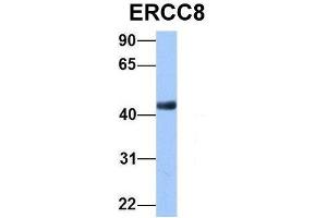 Host:  Rabbit  Target Name:  ERCC8  Sample Type:  Human Fetal Brain  Antibody Dilution:  1.