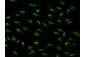 Immunofluorescence of monoclonal antibody to OXSR1 on HeLa cell. (OXSR1 anticorps  (AA 351-450))