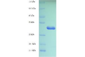 SDS-PAGE (SDS) image for Ionized Calcium-binding Adapter Molecule 1 (IBA1) (AA 2-147) protein (His-SUMO Tag) (ABIN5709023)