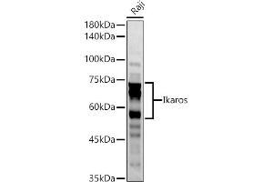Western blot analysis of extracts of Raji cells, using Ikaros antibody (ABIN3015621, ABIN3015622, ABIN3015623, ABIN1680423 and ABIN6218979) at 1:1000 dilution.