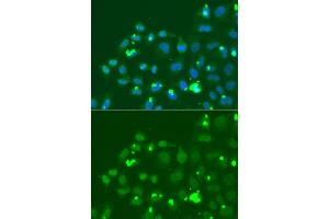 Immunofluorescence analysis of A549 cell using ATF3 antibody. (ATF3 anticorps)