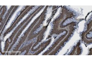 IHC analysis of PARP using anti-PARP antibody (ABIN7602277). (PARP1 anticorps  (AA 670-858))