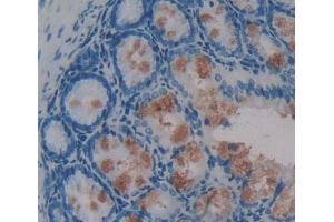 Used in DAB staining on fromalin fixed paraffin- embedded intestine tissue (Phospholipase C beta 2 anticorps  (AA 1-250))