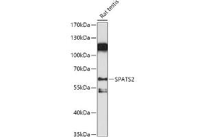 Western blot analysis of extracts of Rat testis, using SP antibody (ABIN7270526) at 1:1000 dilution. (SPATS2 anticorps  (AA 1-240))