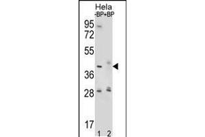 Western blot analysis of HYAL2 Antibody Pab pre-incubated without(lane 1) and with(lane 2) blocking peptide in Hela cell line lysate. (HYAL2 anticorps  (AA 128-157))