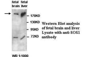 Image no. 1 for anti-Son of Sevenless Homolog 1 (SOS1) antibody (ABIN791240) (SOS1 anticorps)