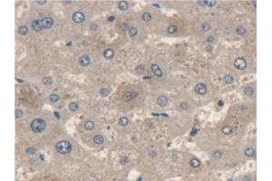 Detection of ME2 in Human Liver Tissue using Polyclonal Antibody to Malic Enzyme 2, NADP+ Dependent, Mitochondrial (ME2) (Malic Enzyme 2, NADP+ Dependent, Mitochondrial (AA 220-426) anticorps)