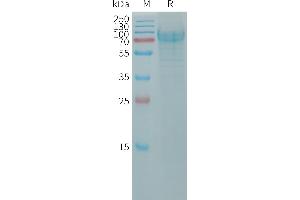 Human PO Protein, His Tag on SDS-PAGE under reducing condition.