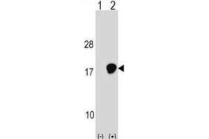 Western Blotting (WB) image for anti-Ubiquitin-Conjugating Enzyme E2D 3 (UBE2D3) antibody (ABIN2999003) (UBE2D3 anticorps)