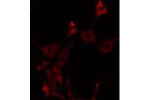 ABIN6275765 staining NIH-3T3 by IF/ICC.