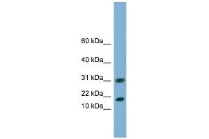 WB Suggested Anti-EIF5A2 Antibody Titration: 0. (EIF5A2 anticorps  (N-Term))