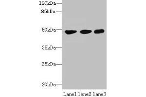 Western blot All lanes: UXS1 antibody at 6 μg/mL Lane 1: Mouse lung tissue Lane 2: Jurkat whole cell lysate Lane 3: HepG2 whole cell lysate Secondary Goat polyclonal to rabbit IgG at 1/10000 dilution Predicted band size: 48, 49, 29 kDa Observed band size: 48 kDa (UXS1 anticorps  (AA 201-420))