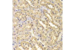 Immunohistochemistry of paraffin-embedded Mouse kidney using CDK9 antibody at dilution of 1:100 (x400 lens). (CDK9 anticorps  (AA 153-372))