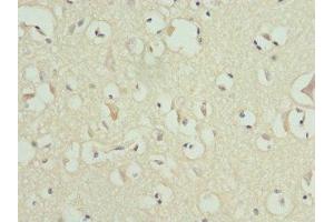 Immunohistochemistry of paraffin-embedded human brain tissue using ABIN7159178 at dilution of 1:100 (MATK anticorps  (AA 393-507))