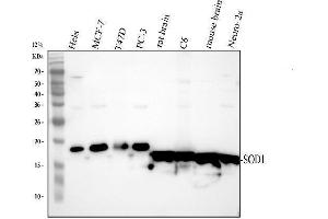 Western blot analysis of SOD1 using anti-SOD1 antibody (ABIN3043438). (SOD1 anticorps  (C-Term))