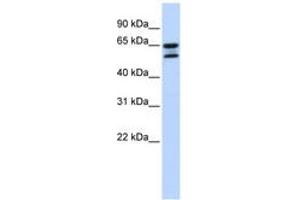Image no. 1 for anti-Acyl-CoA Thioesterase 11 (ACOT11) (AA 504-553) antibody (ABIN6743818) (ACOT11 anticorps  (AA 504-553))