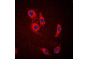 Immunofluorescent analysis of NCKX1 staining in HeLa cells. (SLC24A1 anticorps  (Center))