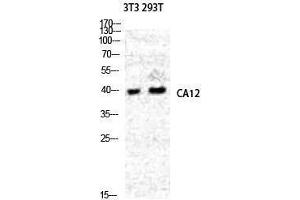 Western Blotting (WB) image for anti-Carbonic Anhydrase 12 (CA12) (Internal Region) antibody (ABIN3180517) (CA12 anticorps  (Internal Region))