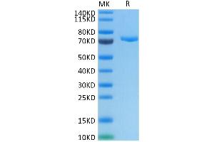 Human Nectin-4 on Tris-Bis PAGE under reduced conditions.